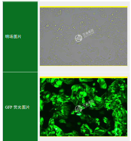 GFP-人肝癌细胞(HEPG2-C3A)