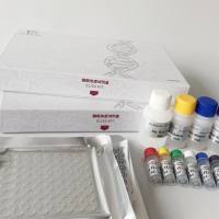 Hepatitis G Virus(HGV)庚型肝炎病毒探针法荧光定量PCR试剂盒