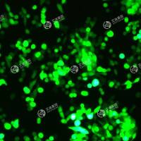 GFP-人胃癌细胞(MKN45)