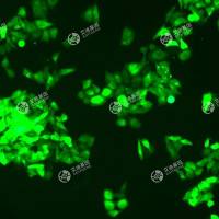 GFP-人胃腺癌细胞(SGC-7911)