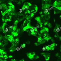 GFP-人肝癌细胞(Hep G2)