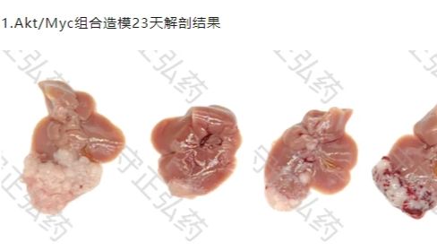 肝癌体细胞基因编辑小鼠模型