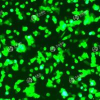 GFP-人结直肠腺癌细胞(HCT116)