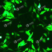 GFP-人宫颈癌细胞(Hela)