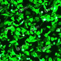 GFP-人恶性黑色素瘤细胞(A375)