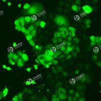 GFP-人卵巢癌细胞(OVCAR-3)