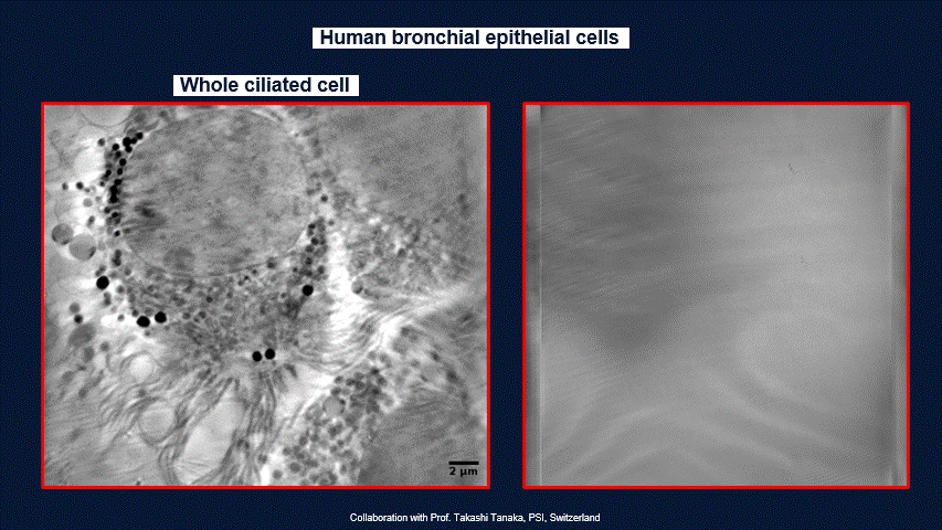 软X射线细胞结构显微镜——SXT-100