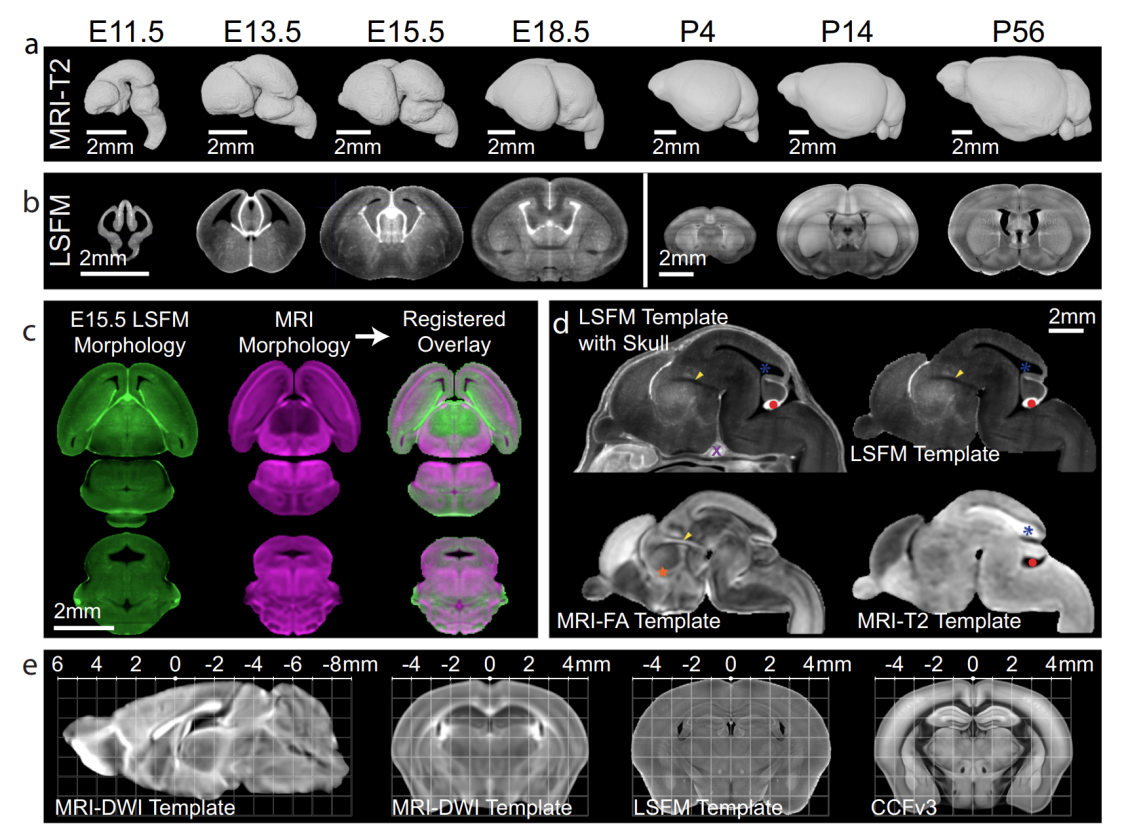 Nature communications | 神经科学革命性新工具——绘制不同发育阶段小鼠全脑三维脑图谱（DevCCF）