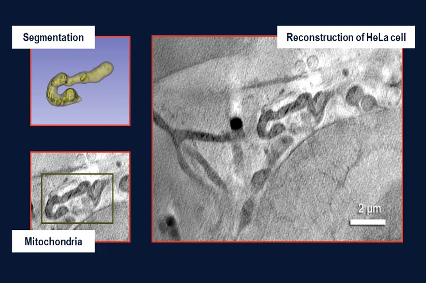 软X射线细胞结构显微镜——SXT-100