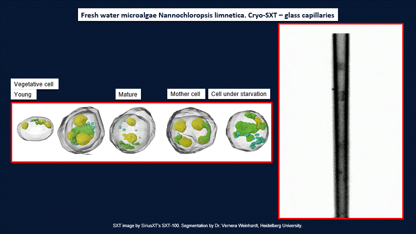软X射线细胞结构显微镜——SXT-100