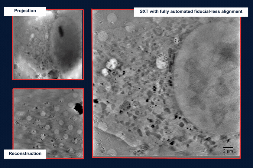 软X射线细胞结构显微镜——SXT-100