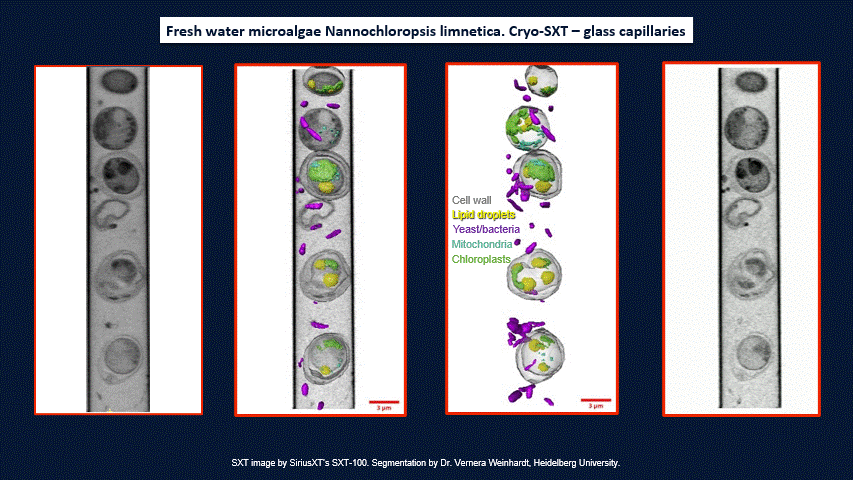 软X射线细胞结构显微镜——SXT-100