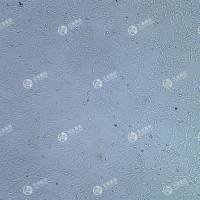 FLUC-人甲状腺状癌细胞(MDA-T41)