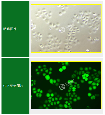 GFP-人肾上腺皮质小细胞癌细胞(SW-13)