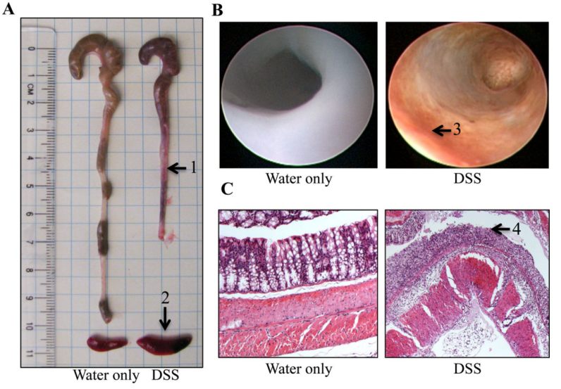 DSS诱导小鼠结肠炎的文献案例操作步骤