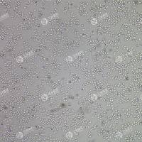 FLUC-人肾上腺皮质小细胞癌细胞(SW-13)