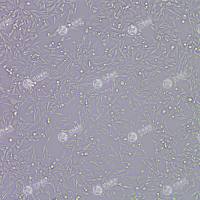 FLUC-小鼠膀胱癌细胞(MB49)