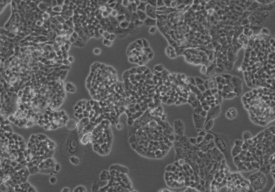 购买之细胞冷冻管经解冻后，为何会发生细胞数目太少之情形？