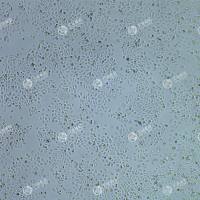 FLUC-人舌鳞癌细胞(SCC-25)