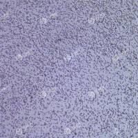 FLUC-小鼠骨髓瘤细胞(SP2/0-AG14)