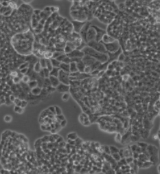 如何避免血清中沉淀物的出现？