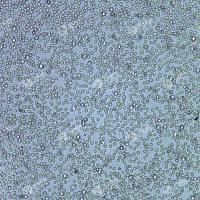 FLUC-人NK/T细胞淋巴瘤细胞(SNT-8)