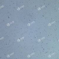 FLUC-人甲状腺状癌细胞(MDA-T32)