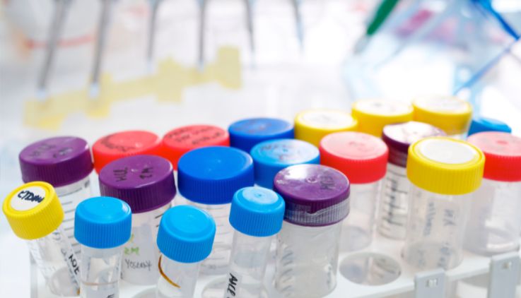 单位IU/ml和拷贝/ml有什么区别