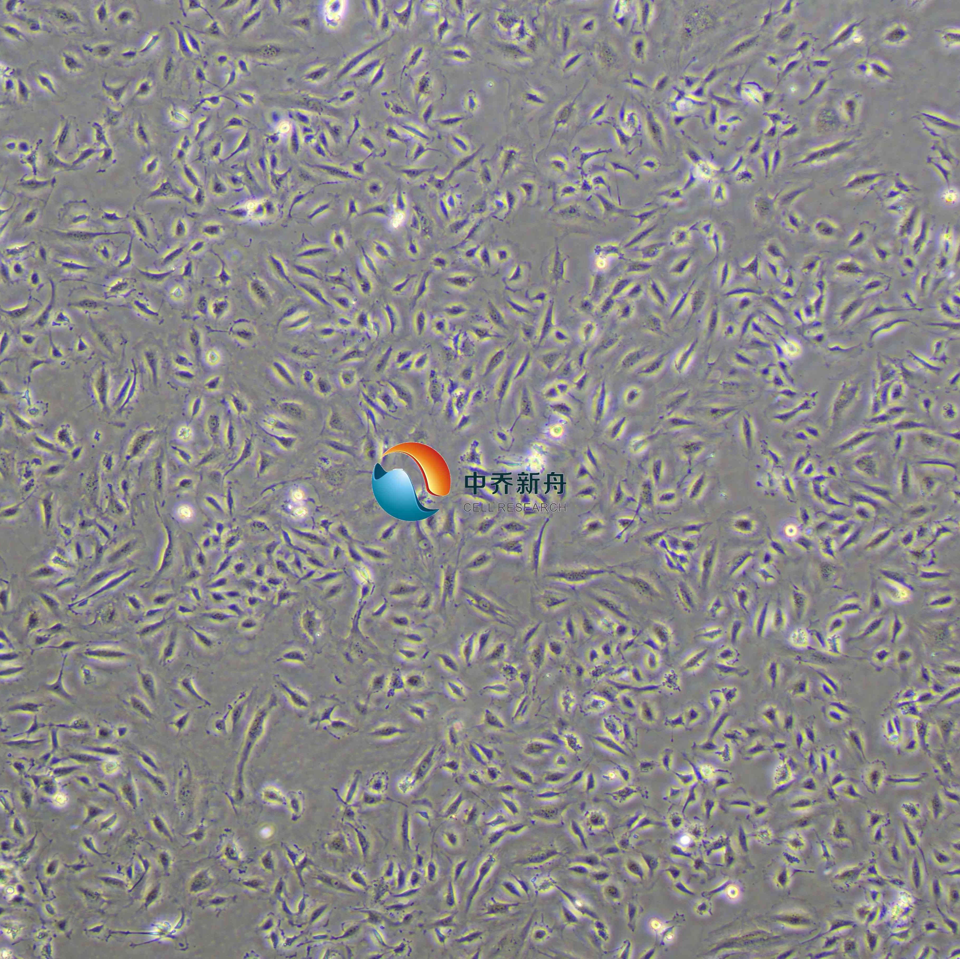 人脐静脉内皮细胞-永生化 （细胞+500ml专培套装）