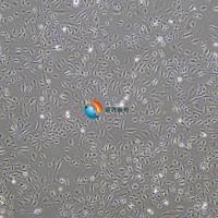 人脐静脉内皮细胞-永生化 (细胞+500ml专培套装)