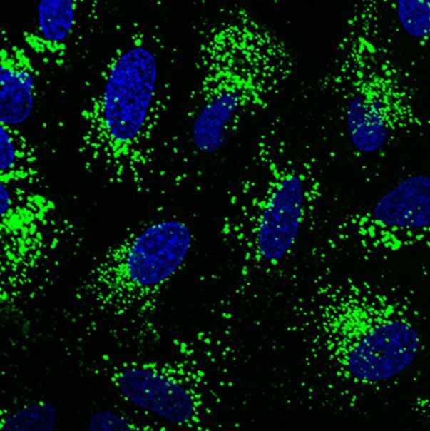 DQ-BSA-Red/DQ-BSA-Green溶酶体活性检测