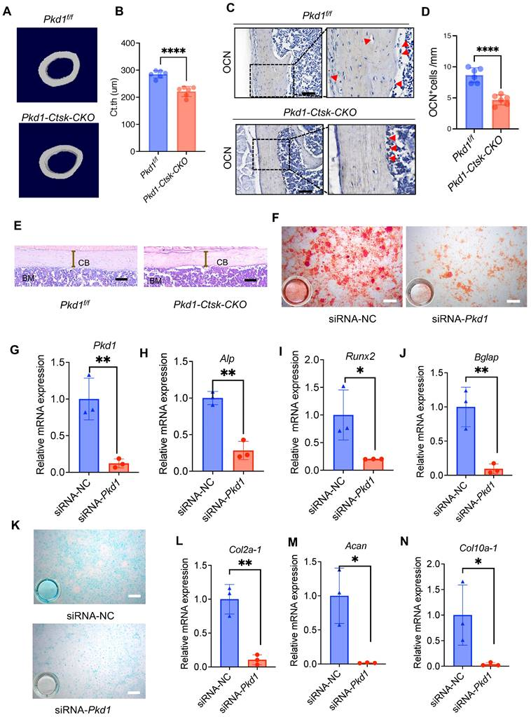 机械敏感的多囊蛋白1促进骨膜干/祖细胞在骨折愈合中的骨软骨分化