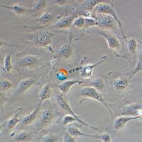 人肺动脉内皮细胞