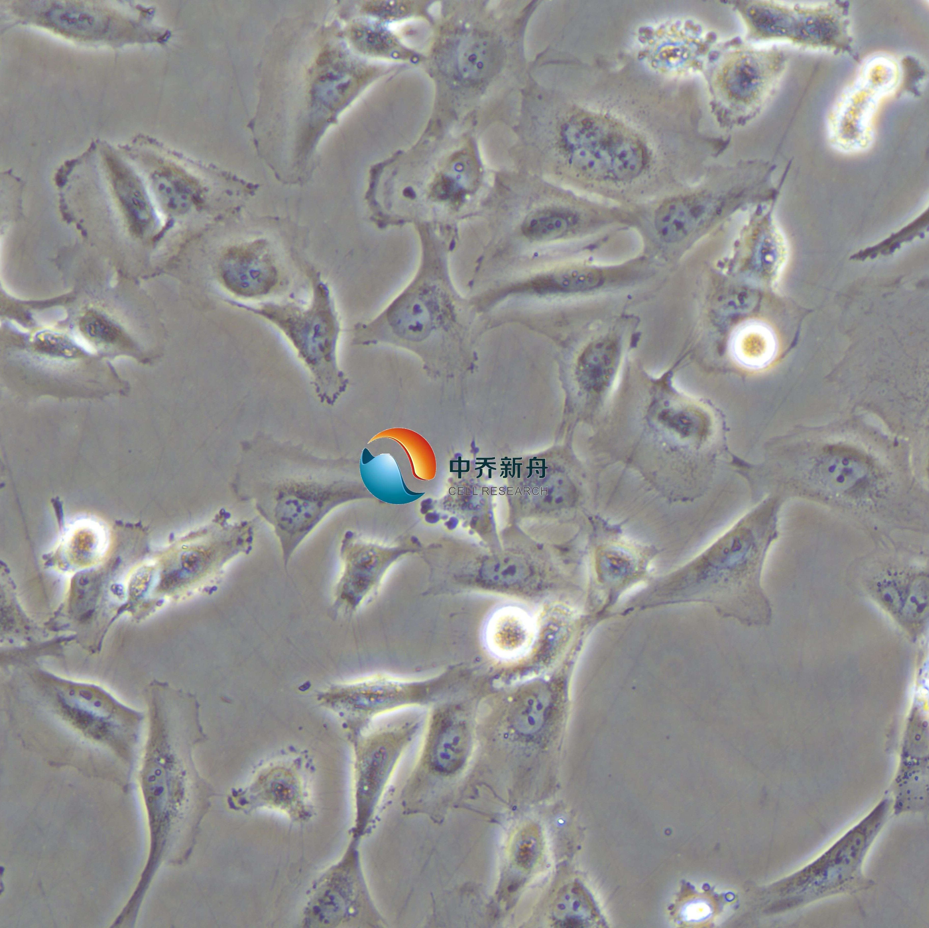 AC16人心肌细胞(STR鉴定)