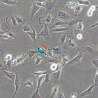 AC16人心肌细胞(STR鉴定)