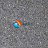 人肺泡上皮细胞(I型和II型混合型）