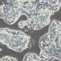 Hep-G2/2.2.15表达HBV病毒的人肝细胞