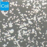 Ana1细胞 | Ana-1细胞 | 小鼠巨噬细胞 |  巨噬细胞 | Ana-1 | Ana1