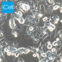 MHCC-97H |MHCC-97H细胞|MHCC-97H|MHCC97H|MHCC97H细胞|人高转移性肝癌细胞|STR鉴定|镜像绮点（Cellverse）