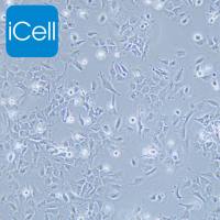 HMC3、HMC3细胞、HMC3细胞|HMC3、人小胶质细胞STR鉴定