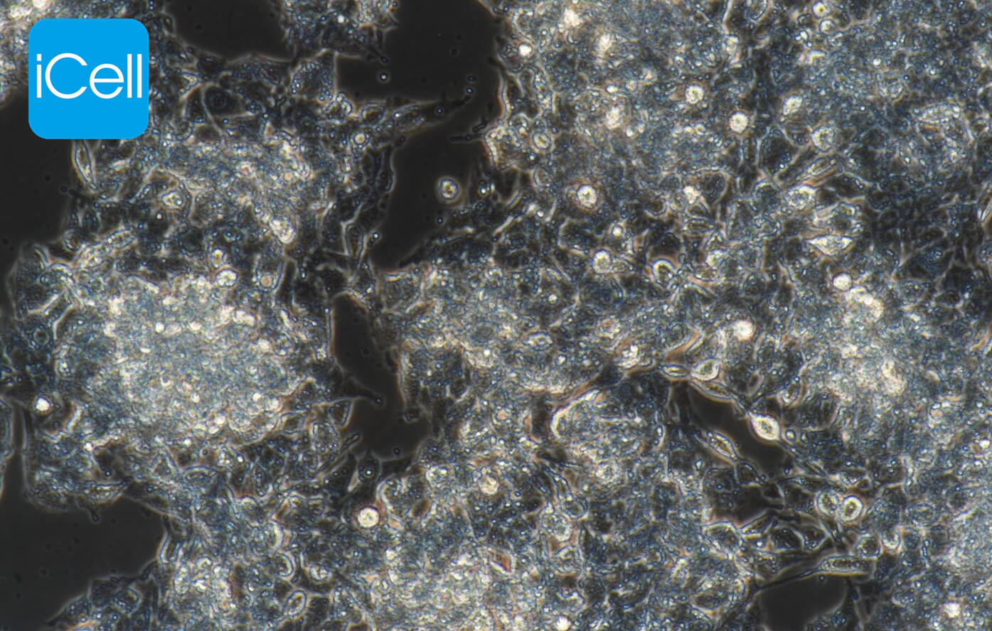 Hep G2 | HepG2 | hepg2细胞 | hep