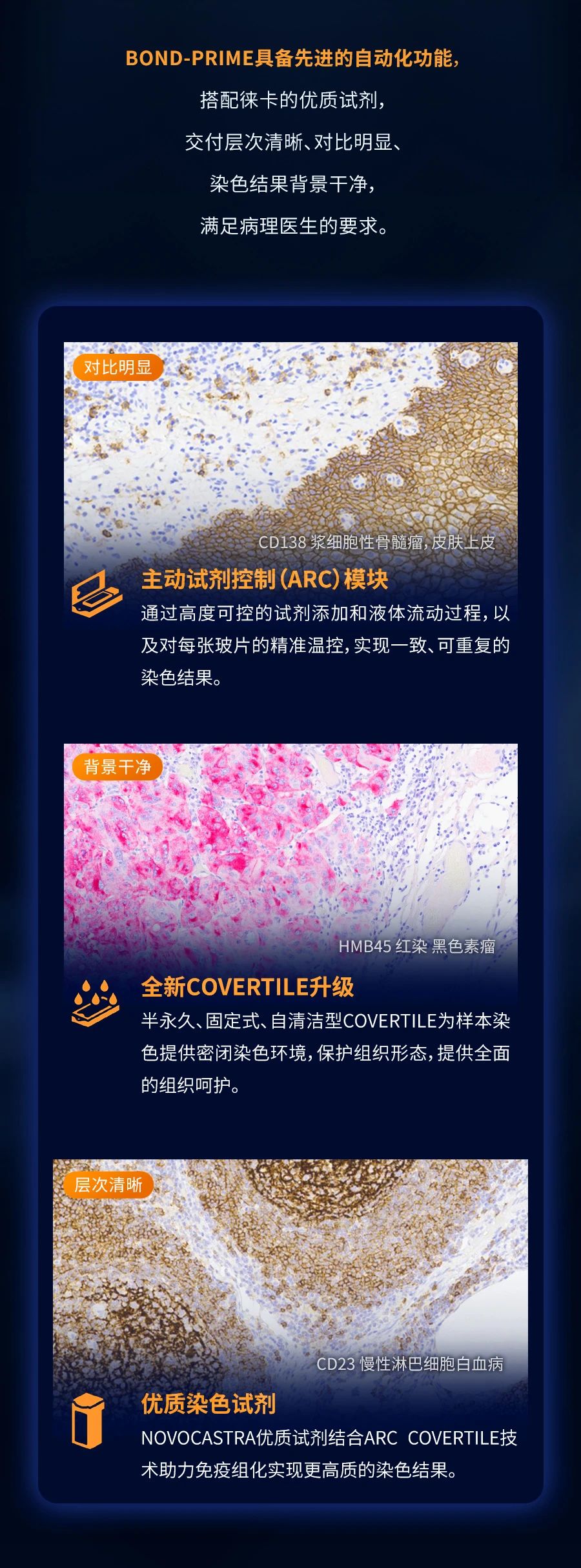 匠心品质，卓越非凡 BOND-PRIME-全自动免疫组化独立控温单独滴染染色机