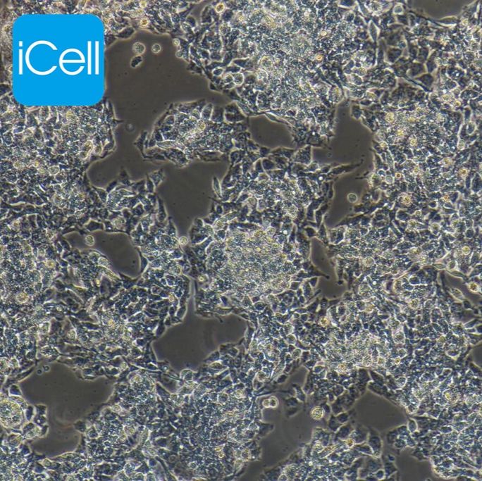 Hep G2 | HepG2 | hepg2细胞 | hepg2 | hepg2细胞培养基 | 人肝癌细胞 |STR鉴定