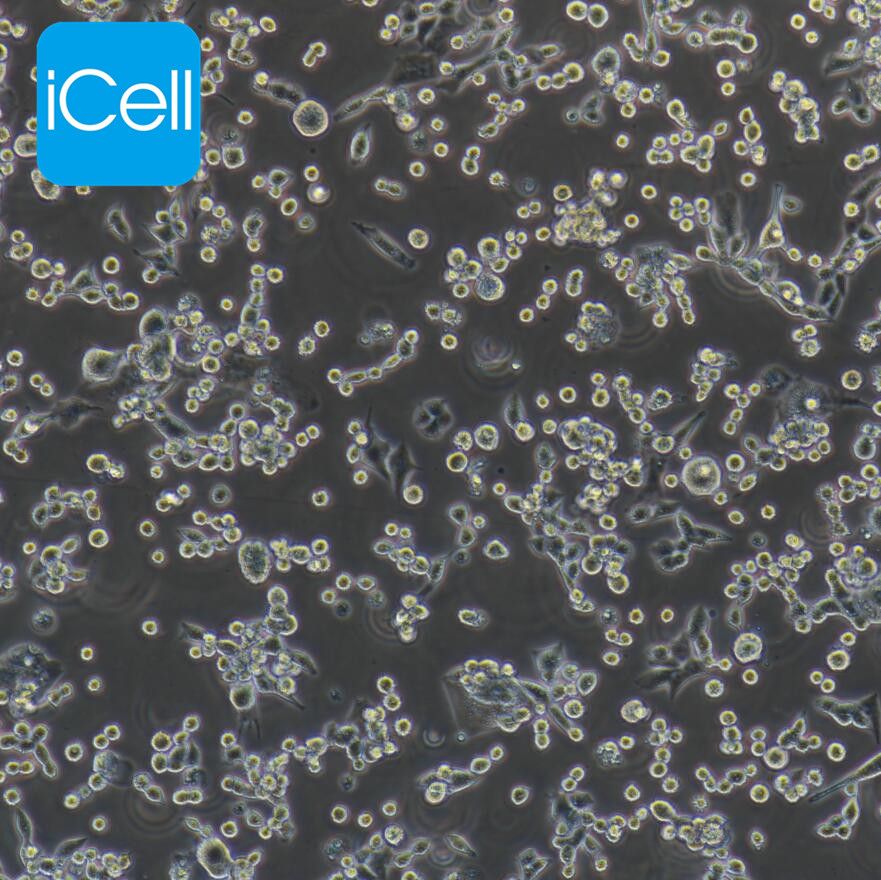LLC 小鼠Lewis肺癌细胞/LLC细胞/LLC细胞/镜像绮点(Cellverse)