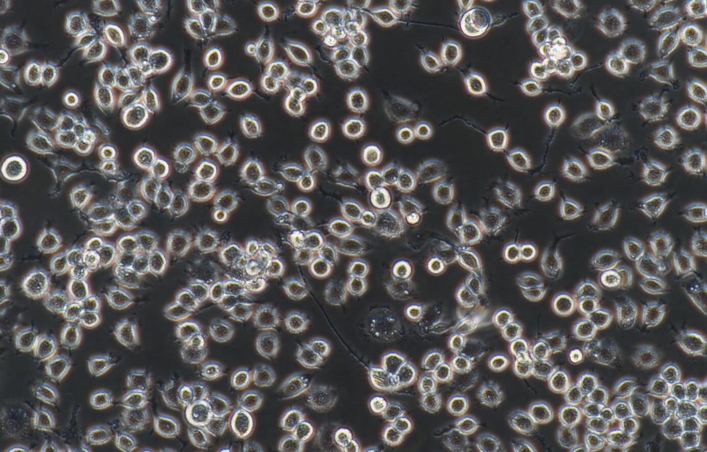 J774A.1 小鼠单核巨噬细胞|J774A.1|J774A