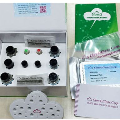 细胞外基质磷酸糖蛋白(MEPE)重组蛋白