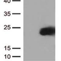 IL2 Mouse Monoclonal Antibody [Clone ID: OTI5A9]