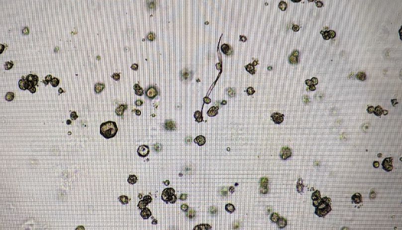 为啥类器官传代后基本不长呢？