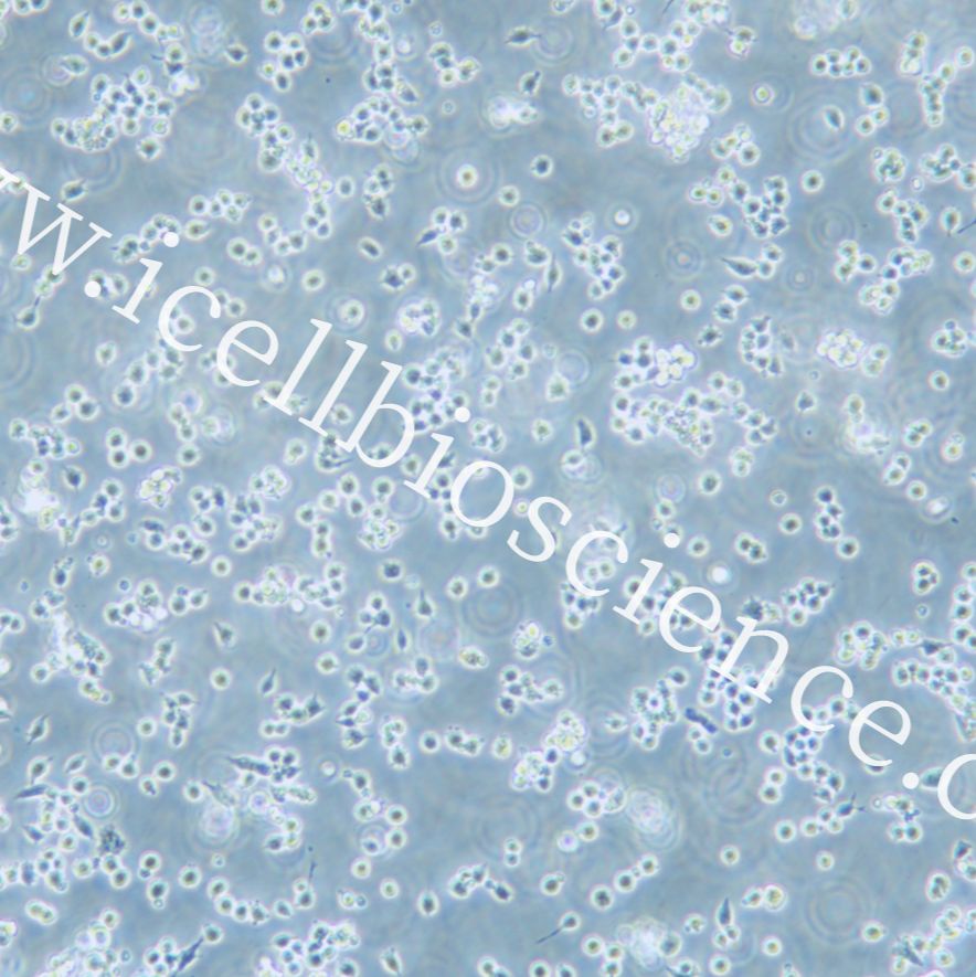 A20 小鼠B细胞淋巴瘤细胞/A20/A20细胞/A-20/A-20细胞/STR鉴定