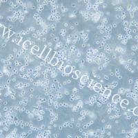 A20 小鼠B细胞淋巴瘤细胞/A20/A20细胞/A-20/A-20细胞/STR鉴定